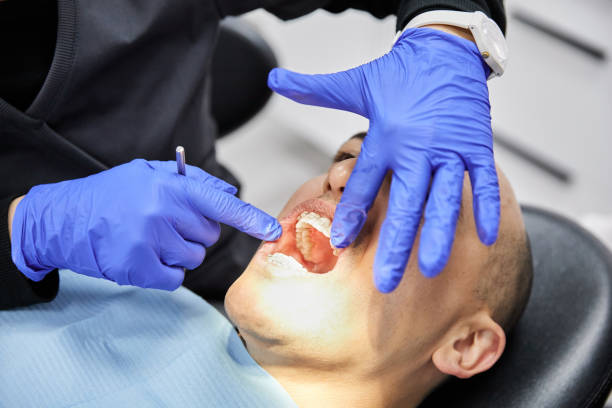 Best Dental Abscess Treatment in Tularosa, NM